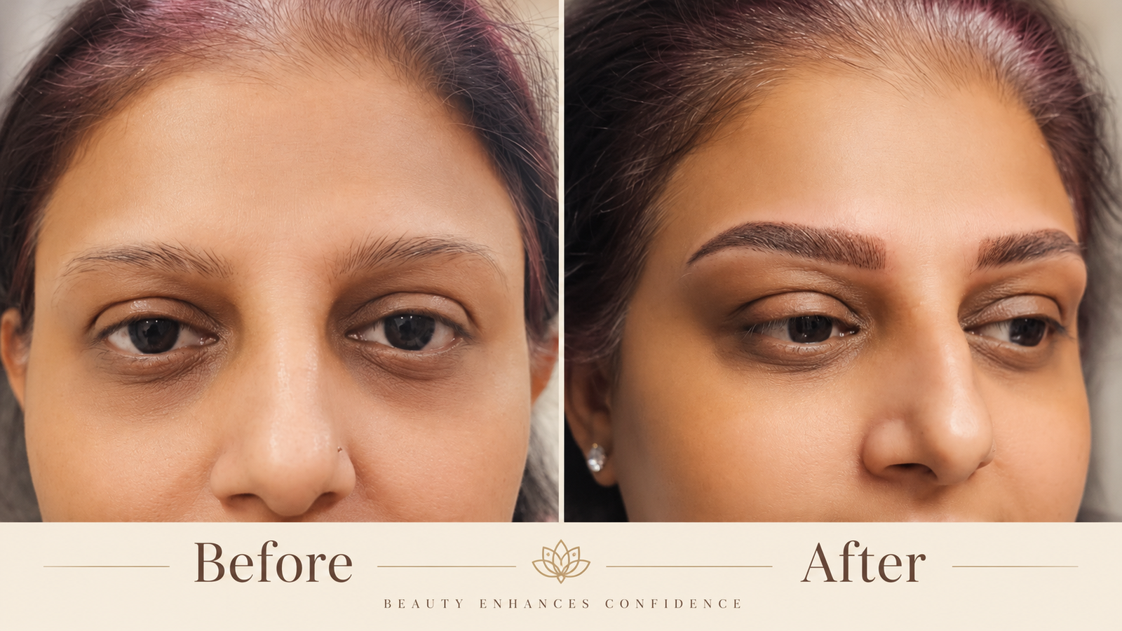 Combination Brows — before and after