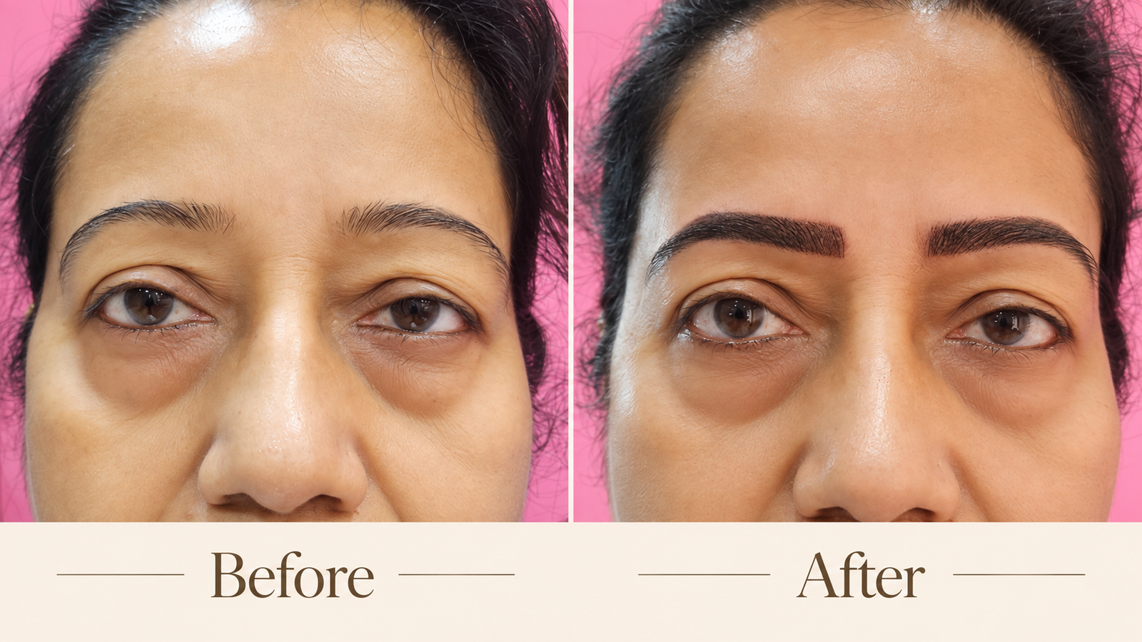 Combination Brows before and after — client 6